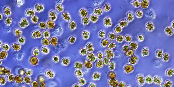 Microbia lève des fonds pour détecter les algues toxiques